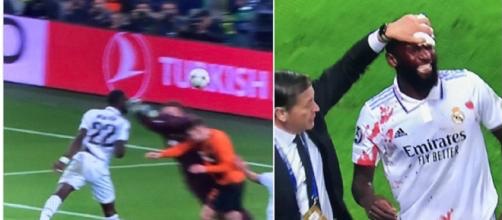 L'incroyable égalisation d'Antonio Rüdiger en sang fait le buzz 