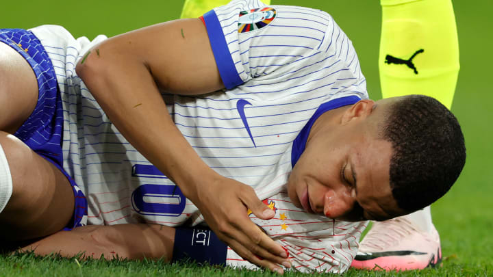 Fracture du nez pour Mbappé