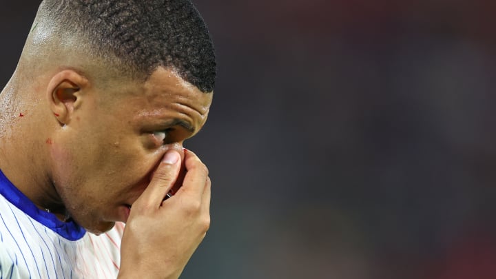 Fracture du nez pour Mbappé