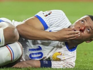 Le masque de Mbappé